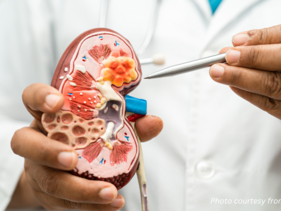 7M Filipinos have chronic kidney disease as of 2021